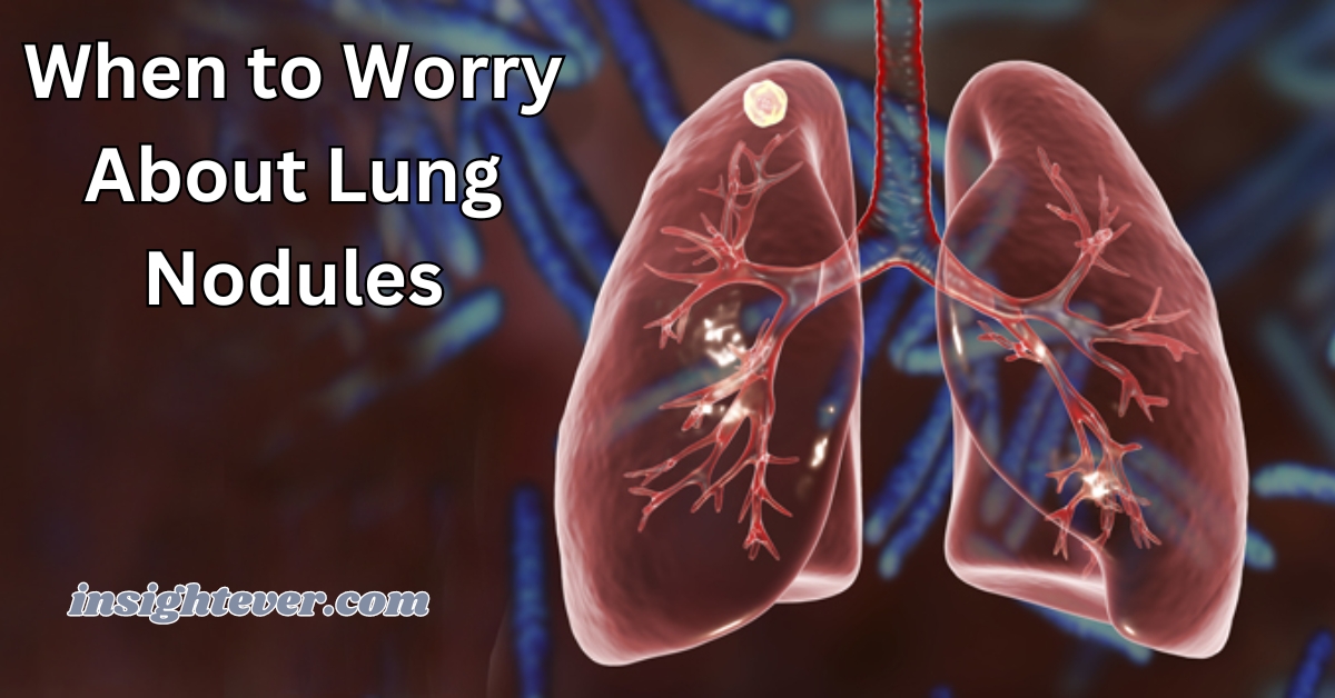 when to worry about lung nodules